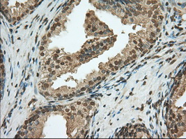 m02714 anti pde4a mouse monoclonal antibody clone id oti7b11 ihc testing 5
