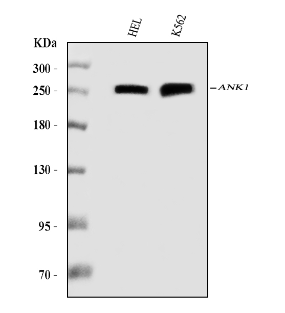  Western blot analysis of Ankyrin erythroid/ANK/ANK1 using anti-Ankyrin erythroid/ANK/ANK1 antibody (M02716-1)