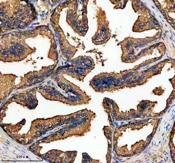 m02718 1 azgp1 primary antibodies ihc testing 1