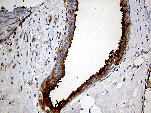 Immunohistochemical staining of paraffin-embedded Human breast tissue within the normal limits using anti-AZGP1 mouse monoclonal antibody