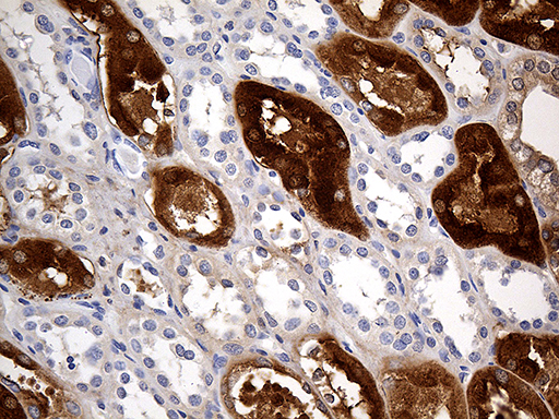 m02718 anti zinc alpha 2 glycoprotein azgp1 mouse monoclonal antibody clone id oti10f2 ihc testing 4