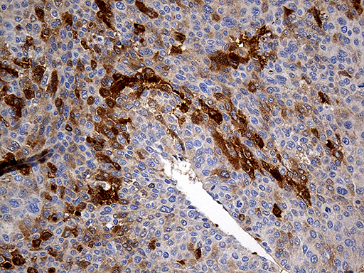 m02718 anti zinc alpha 2 glycoprotein azgp1 mouse monoclonal antibody clone id oti10f2 ihc testing 6