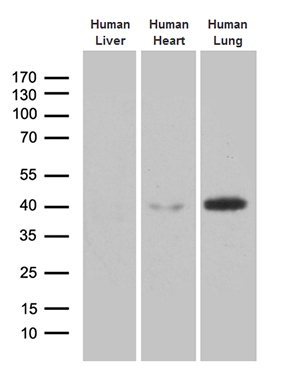 Western blot analysis of extracts (35ug) from 3 tissue lysates by using anti-AZGP1 monoclonal antibody (1:500)