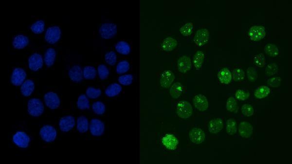 m02719 2 rcc1 primary antibodies if testing 7_1