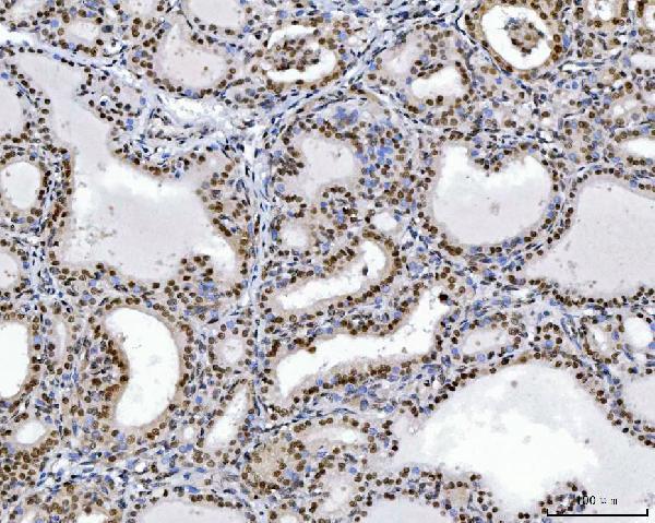  IHC analysis of RCC1 using anti-RCC1 antibody (M02719-2)