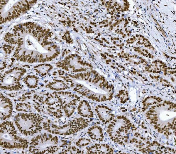  IHC analysis of RCC1 using anti-RCC1 antibody (M02719-2)