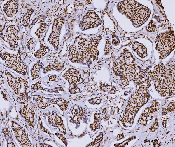 m02719 2 rcc1 primary antibodies ihc testing 4_1