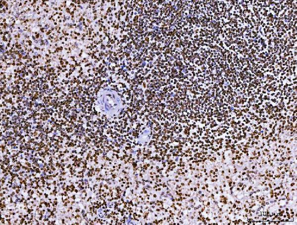 m02719 2 rcc1 primary antibodies ihc testing 5_1