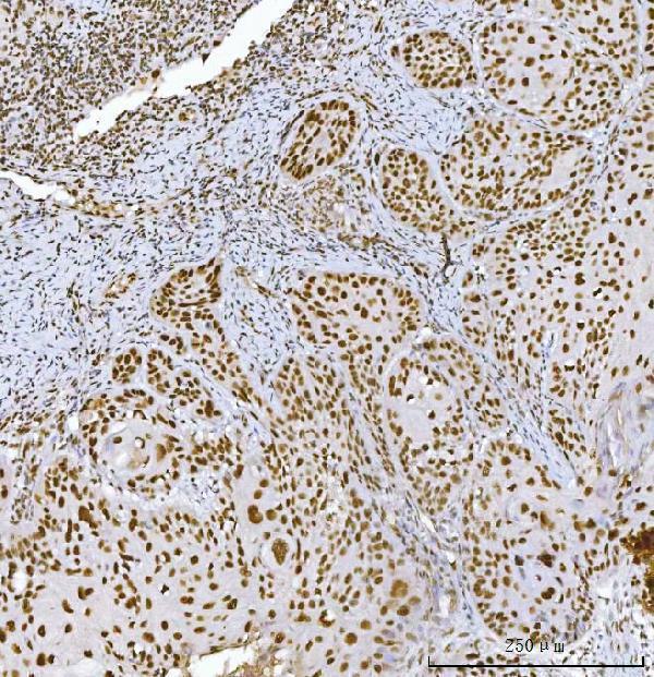 m02719 2 rcc1 primary antibodies ihc testing 6_1