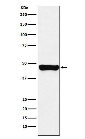 Western blot analysis of RCC1 expression in A431 cell lysate