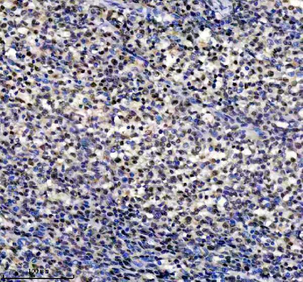 m02726 hnrnpc primary antibodies ihc testing 1