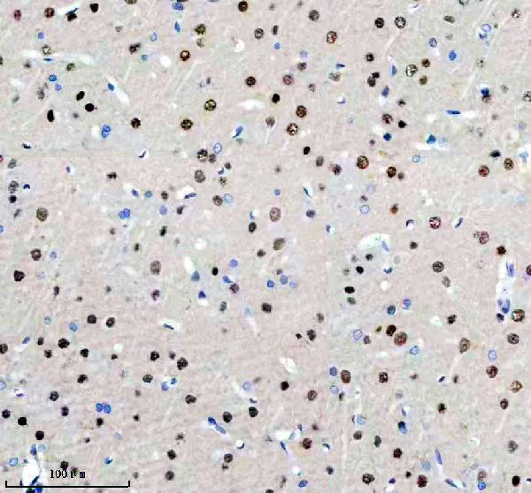 m02726 hnrnpc primary antibodies ihc testing 10