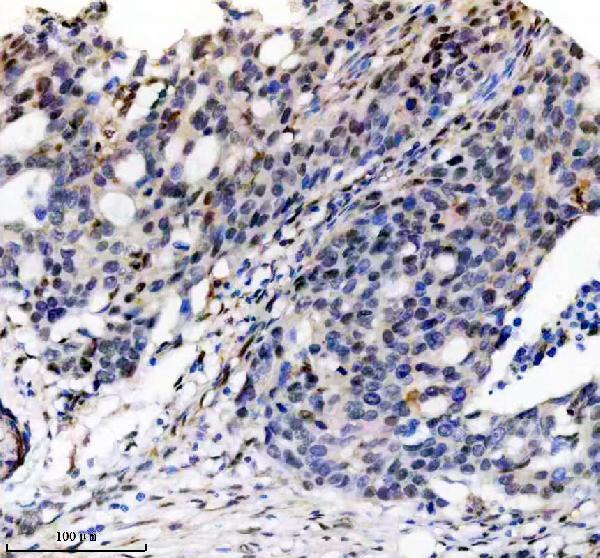 m02726 hnrnpc primary antibodies ihc testing 2