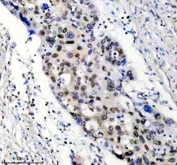 m02726 hnrnpc primary antibodies ihc testing 3
