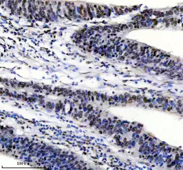 m02726 hnrnpc primary antibodies ihc testing 4