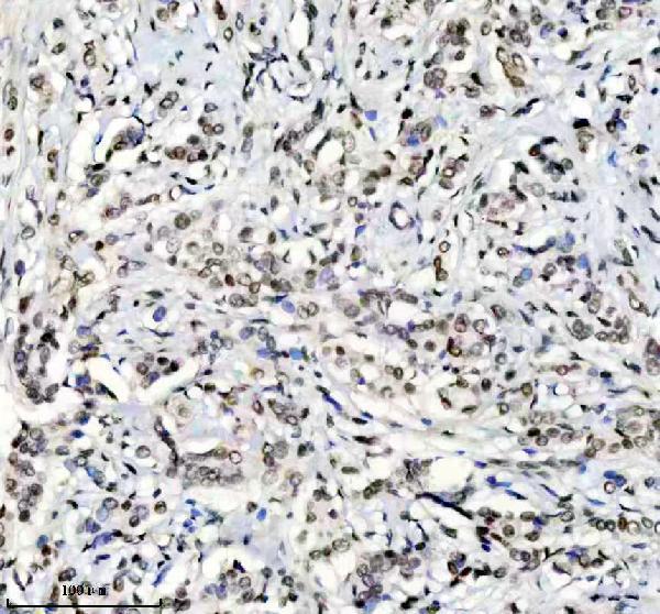 m02726 hnrnpc primary antibodies ihc testing 5