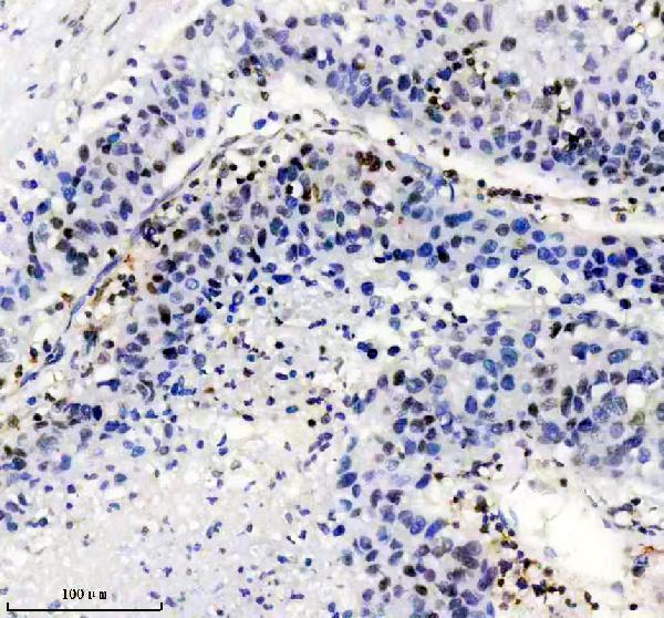 m02726 hnrnpc primary antibodies ihc testing 6