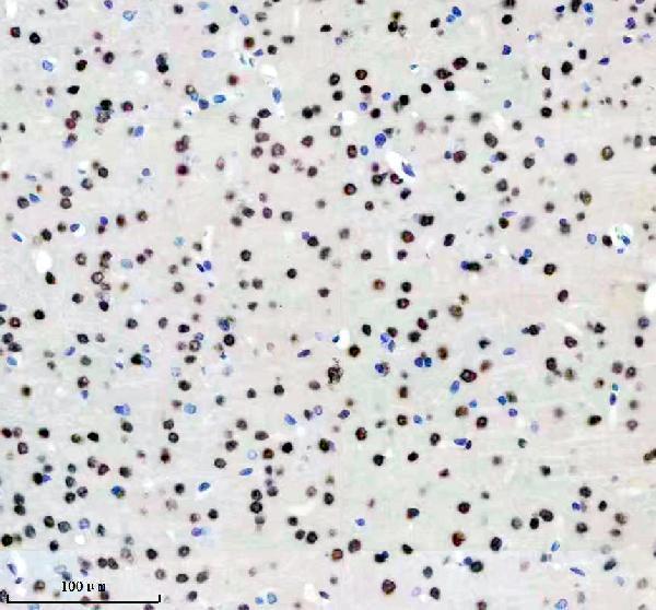 m02726 hnrnpc primary antibodies ihc testing 7