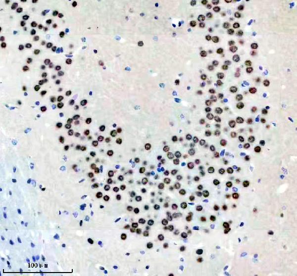 m02726 hnrnpc primary antibodies ihc testing 8