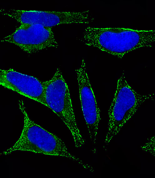 Fluorescent image of SH-SY5Y cells stained with CHRM2 Antibody