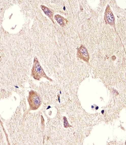 Immunohistochemical analysis of paraffin-embedded H