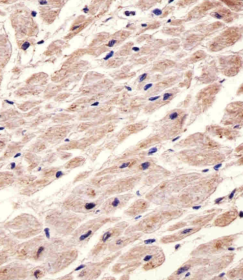 m02733 anti chrm2 antibody ihc p testing 4
