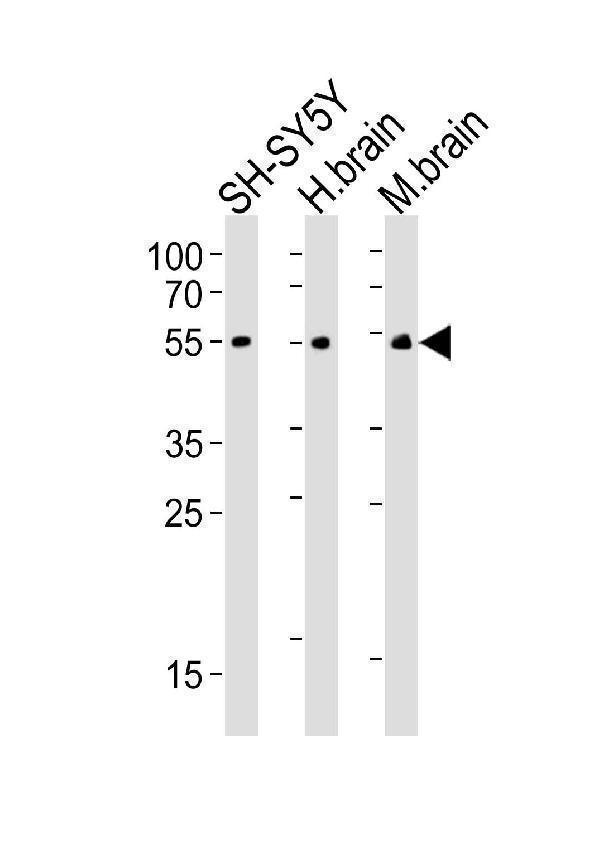 Western blot analysis of lysates from SH-SY5Y cell line, human brain, mouse brain tissue(from left to right), using CHRM2 Antibody
