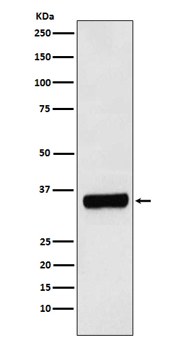 Western blot analysis of PRKRA expression in HepG2 cell lysate