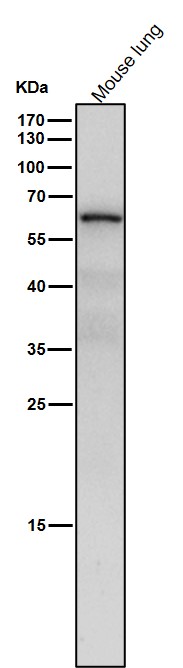 All lanes use the Antibody at 1:4K dilution for 1 hour at room temperature