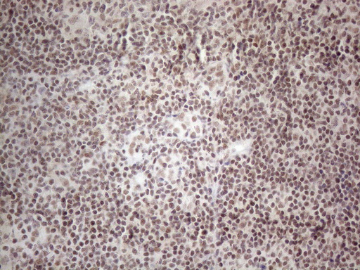 m02752 anti nr2c2 mouse monoclonal antibody clone id oti4b1 ihc testing 15