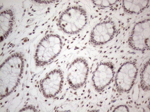 m02752 anti nr2c2 mouse monoclonal antibody clone id oti4b1 ihc testing 16
