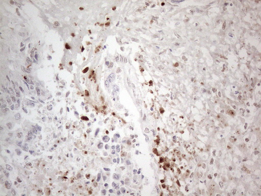 m02752 anti nr2c2 mouse monoclonal antibody clone id oti4b1 ihc testing 17