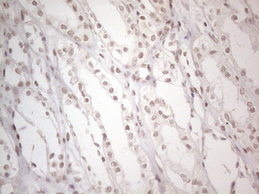 m02752 anti nr2c2 mouse monoclonal antibody clone id oti4b1 ihc testing 18