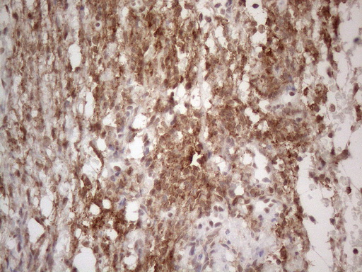 Immunohistochemical staining of paraffin-embedded Human Ovary tissue within the normal limits using anti-NR2C2 mouse monoclonal antibody