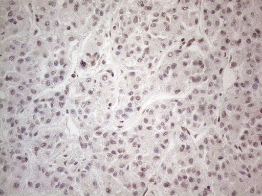 m02752 anti nr2c2 mouse monoclonal antibody clone id oti4b1 ihc testing 20
