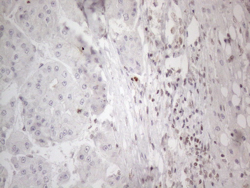 m02752 anti nr2c2 mouse monoclonal antibody clone id oti4b1 ihc testing 21