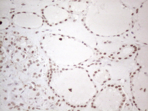m02752 anti nr2c2 mouse monoclonal antibody clone id oti4b1 ihc testing 5