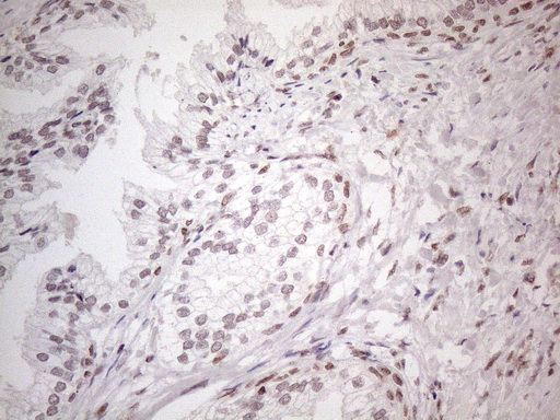 m02752 anti nr2c2 mouse monoclonal antibody clone id oti4b1 ihc testing 9