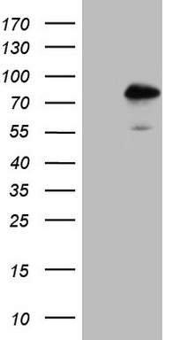 HEK293T cells were transfected with the pCMV6-ENTRY control (Left lane) or pCMV6-ENTRY NR2C2 (Right lane) cDNA for 48 hrs and lysed