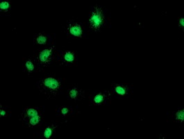 m02754 anti gatm mouse monoclonal antibody clone id oti1e3 if testing 13