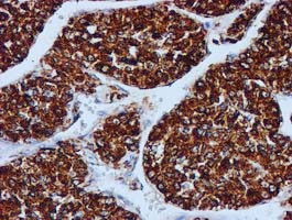 m02754 anti gatm mouse monoclonal antibody clone id oti1e3 ihc testing 10
