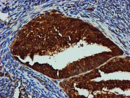 m02754 anti gatm mouse monoclonal antibody clone id oti1e3 ihc testing 4