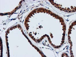 m02754 anti gatm mouse monoclonal antibody clone id oti1e3 ihc testing 5