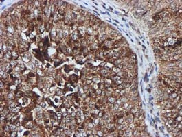 m02754 anti gatm mouse monoclonal antibody clone id oti1e3 ihc testing 6