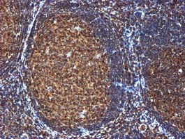 m02754 anti gatm mouse monoclonal antibody clone id oti1e3 ihc testing 7