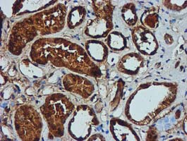 m02754 anti gatm mouse monoclonal antibody clone id oti1e3 ihc testing 8