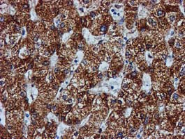 m02754 anti gatm mouse monoclonal antibody clone id oti1e3 ihc testing 9