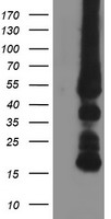 HEK293T cells were transfected with the pCMV6-ENTRY control (Left lane) or pCMV6-ENTRY GATM (Right lane) cDNA for 48 hrs and lysed