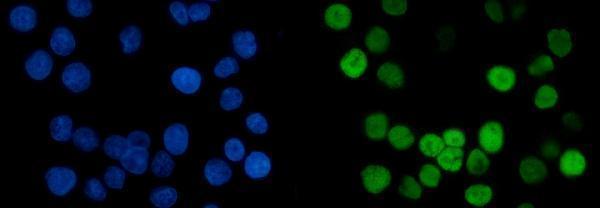 m02755 1 mcm6 primary antibodies if testing 9