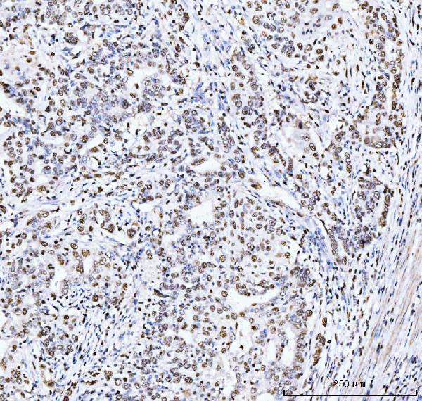  IHC analysis of MCM6 using anti-MCM6 antibody (M02755-1)